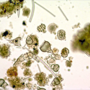 There are definitely organisms, including algae (green), other protists, and small animals.