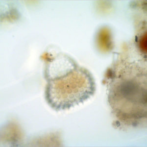 A small protist, from the Kingdom that gave rise to animals and remains abundant in aquatic habitats.