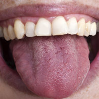 Taste buds scattered on the tongue detect at least five tastes in humans: sweet, sour, salty, bitter, and umami ("savory").