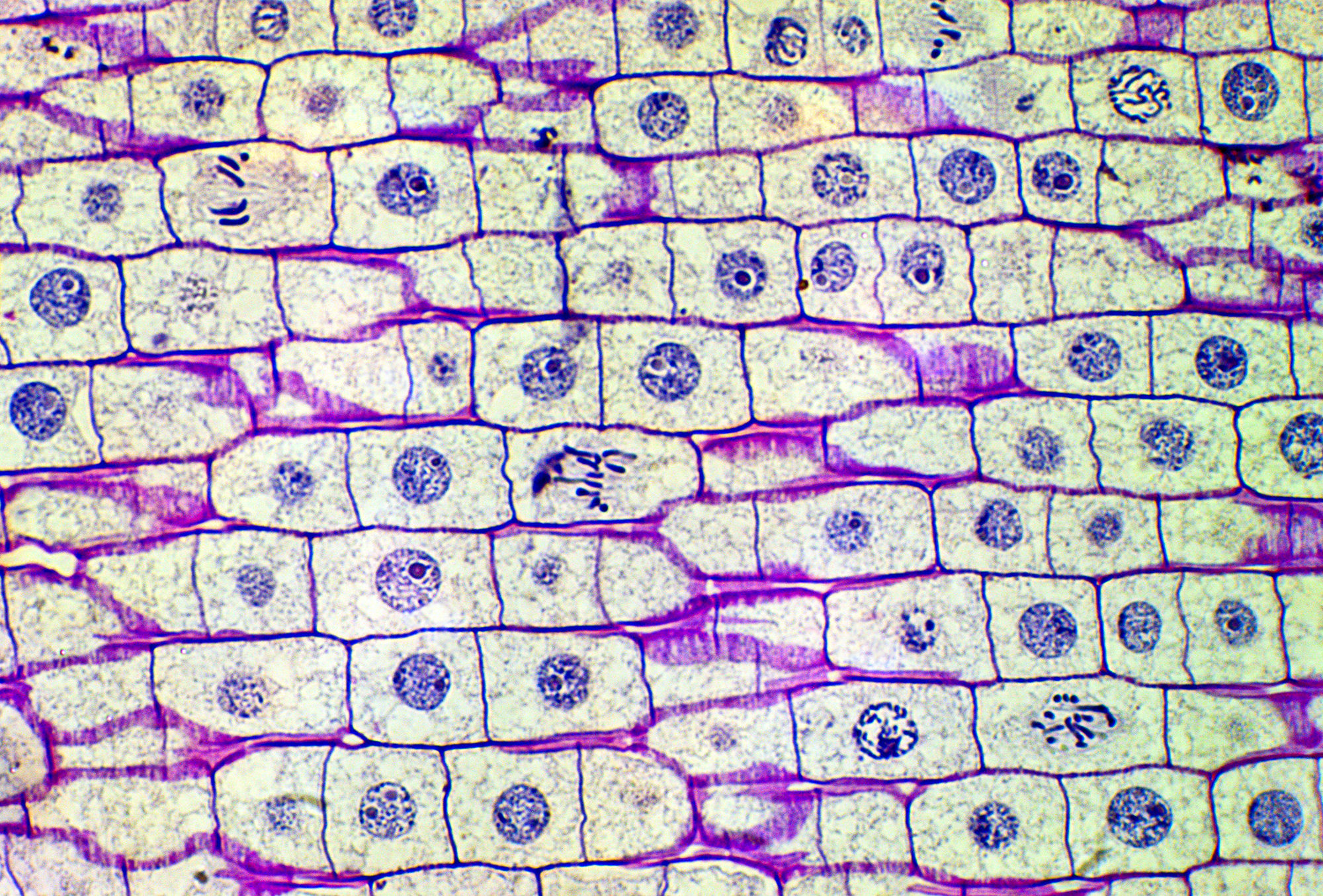 Микропрепарат клеток корешка лука