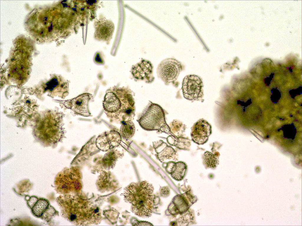 There are definitely organisms, including algae (green), other protists, and small animals.
